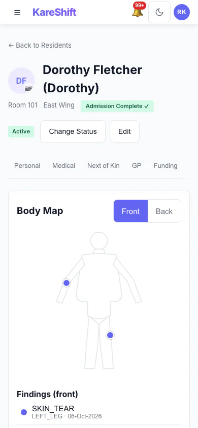 Body Map — Front: Mark skin findings on the front of the body and see them in the resident's record. (mobile view)