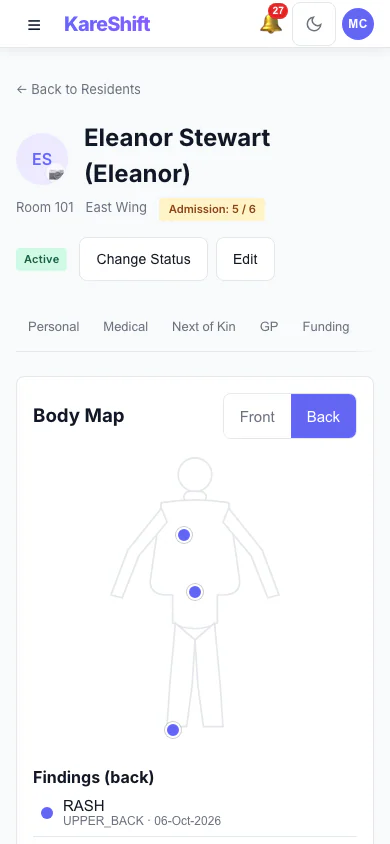 Body Map — Back: Back view with sacrum and heel pressure injuries recorded. (mobile view)