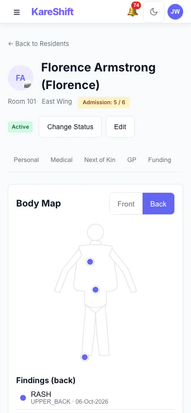 Body Map — Back: Back view with sacrum and heel pressure injuries recorded. (mobile view)