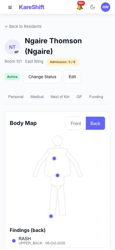 Body Map — Back: Back view with sacrum and heel pressure injuries recorded. (mobile view)